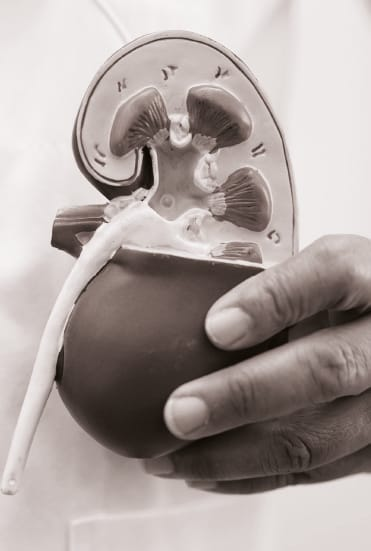 Modelo anatômico de rim — transplante renal no Rio de Janeiro, equipe da UroClínica Rio junto ao Programa Estadual de Transplantes